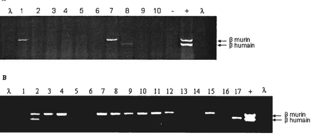 Figure 7 : Expression des gènes adultes de la globine f3 murine et humaine dans les cellules enrichies en progéniteurS