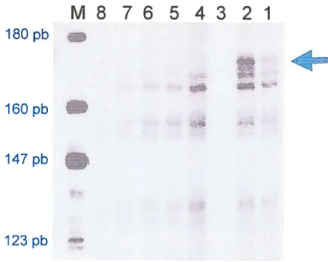 Figure 9. Protection à la RNAse sur la fondatrice LCRI3BPI 13-32 Légende de la figure 9: