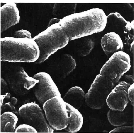 figure 2: Microscopie électronique de la bactérie Gram-négative Escherichia cou