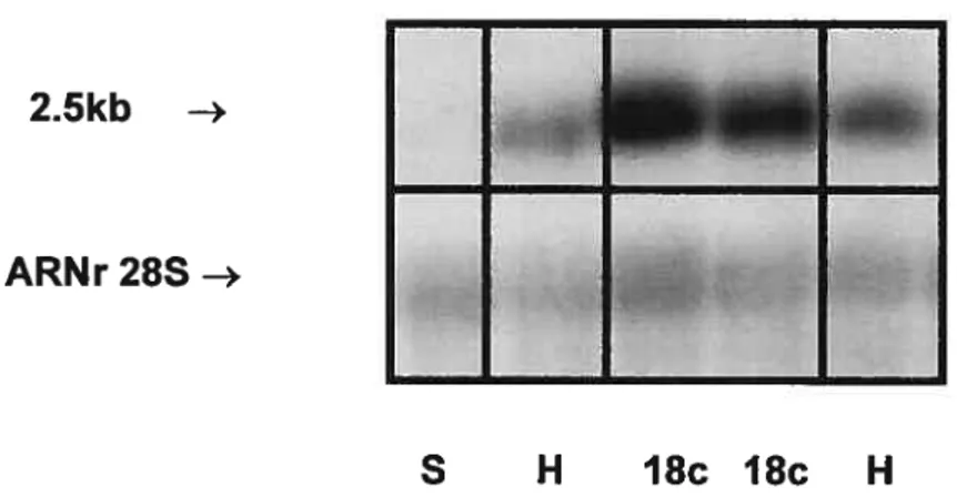 Fig. 8. Représentation autoradiographique d’un buvardage Northern montrant les niveaux de transcrits de 2.5 kb d’ARNm du GHRH-R dans les cellules BHK 570 sauvages (S) et transfectées de façon stable avec Zem2l9b-RPRI8c (18c) ou Zem2l 9b-hGHRH-R (H-témoin positif)