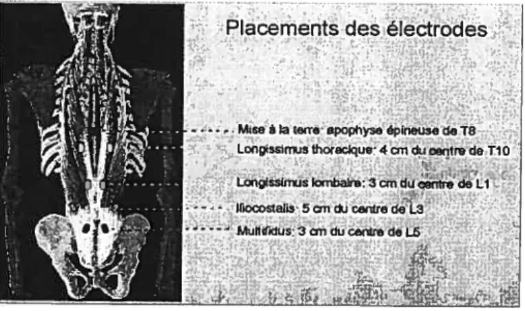 Fig. 02: Position des électrodes EMG