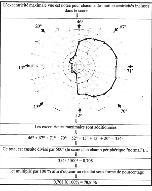 FIGuRE 7: Résumé de ta méthode AMA pour la cotation d’un champ visuel