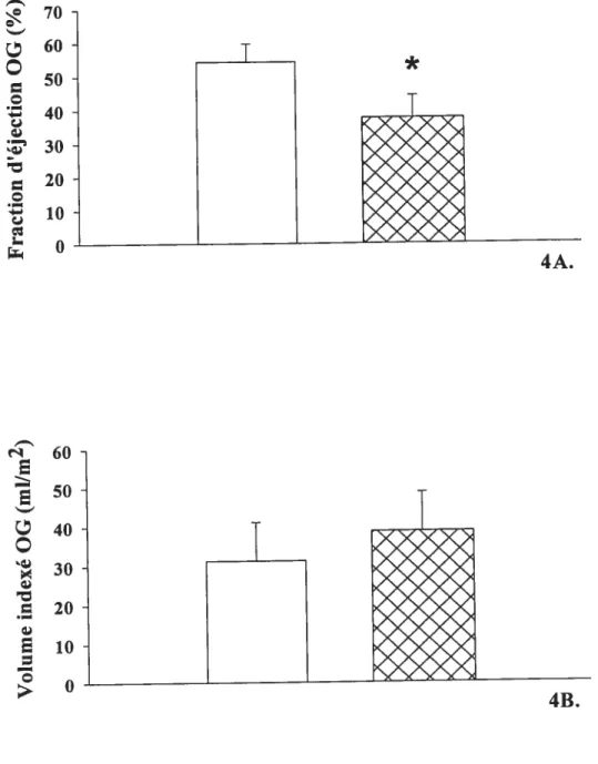 Figure 4. Fonction contractile (4A) et volume indexé (4B) auriculaire gauche dans deux groupes de patients hypertendus avec FA divisés selon une fraction d’éjection auriculaire plus basse ou pins élevée que 45%.