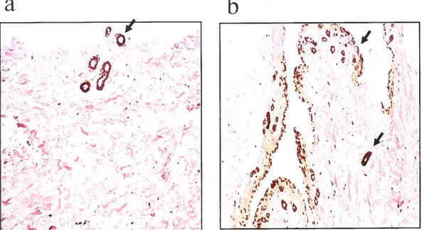 Figure 2 a C Normal b Osteoarth ritis s ET-Ï (304bp) GAPDH 0’CilJ,r S’‘çzf,.,.J:.:,:“4..I