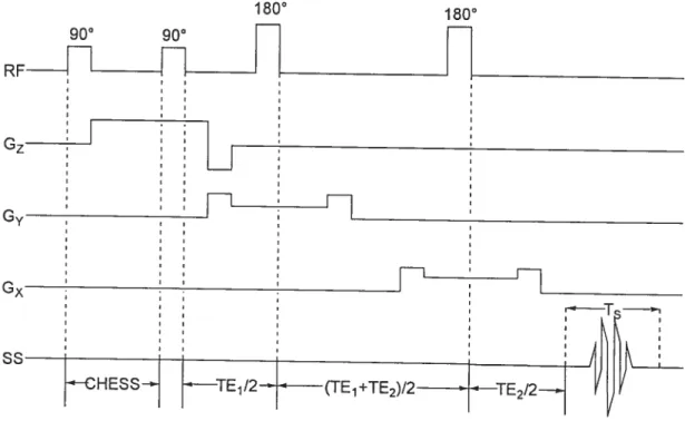 Figure 18. Séquence d’impulsions pour la détection SRM avec la méthode PRESS précédée