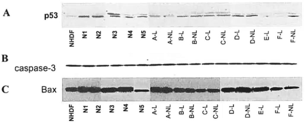 figure 8: Immunoblots de lysats de fibroblastes NHDF, de 5 volontaires sains (Nl-N5) et de peaux lésionnelles (L) et non-lésionnelles (NL) de 6 patients (A-F)