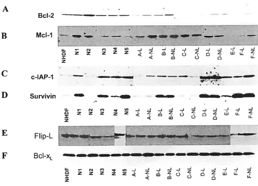 Figure 9: Immunoblots de lysats de fibroblastes NHDF, de 5 volontaires sains (Nl-N5) et de 6 patients (A-F), contre les protéines Bd-2 (A), Mci-1 (B) c-IAP-l (C), survivin (D), FlipL (E) et Bcl-xL (F).