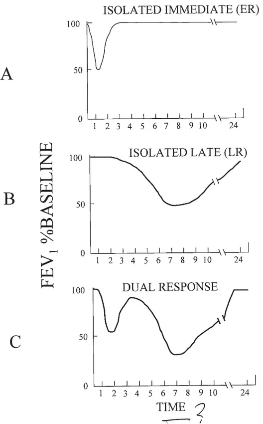 Figure 2: Common patterns ofresponse afier pulmonary antigen challenge