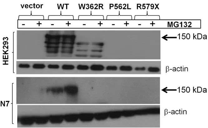Figure 3: SYNGAP1 mutant proteins are unstable in HEK293 and N7 cells.  