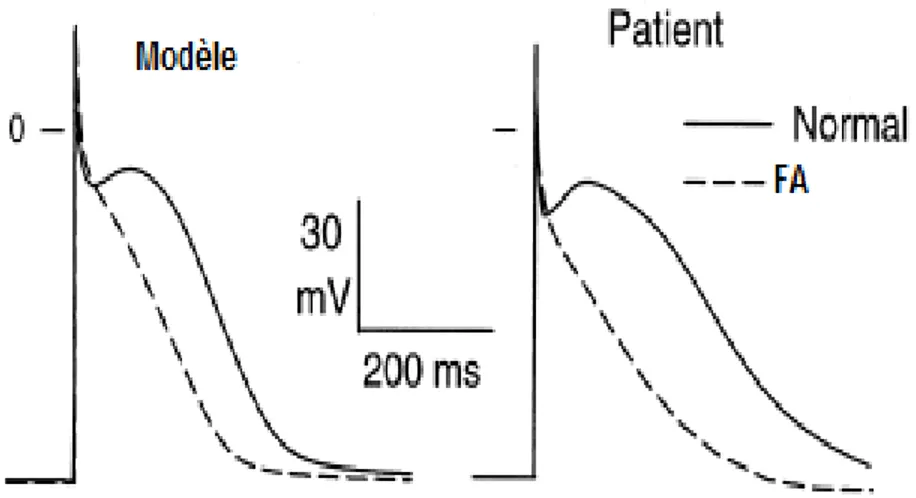 Figure 14 : Comparaison du PA issu du modèle mathématique (à gauche) et du PA enregistré  cliniquement du tissu auriculaire d’un patient (droite)