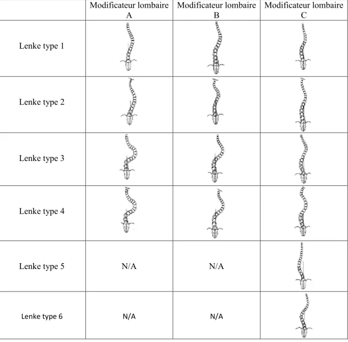 Figure  8  –  Classification de  Lenke  et  al.  Résumé  illustrative  des patrons de  déformation possible de  la  SIA  dans  cette classification