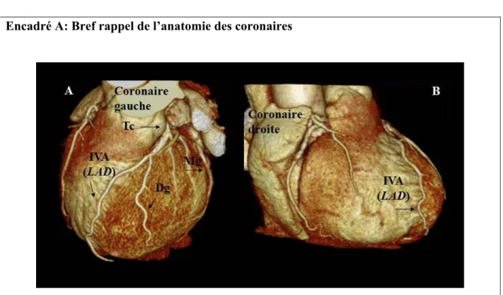 Tableau I : Historique de l’intervention coronarienne percutanée avec tuteur  