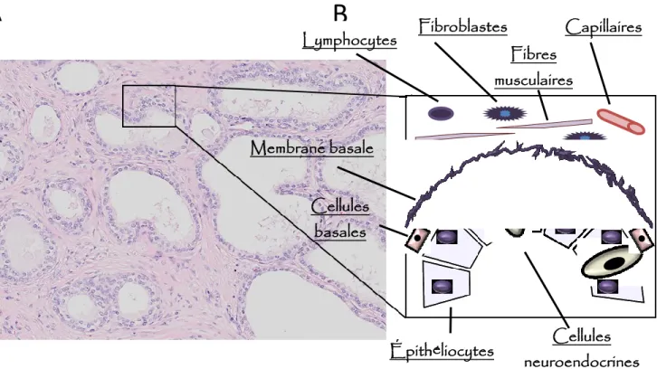 Figure 2. Principaux types cellulaires de la prostate. A. Vue microscopique d’un échantillon de  tissus  glandulaire  prostatique  après  coloration  à  l’hématoxyline  et  à  l’éosine