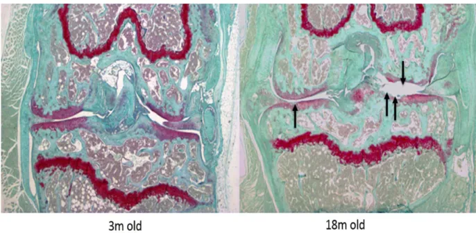 Figure 8: Histological changes in aging-associated osteoarthritis. 