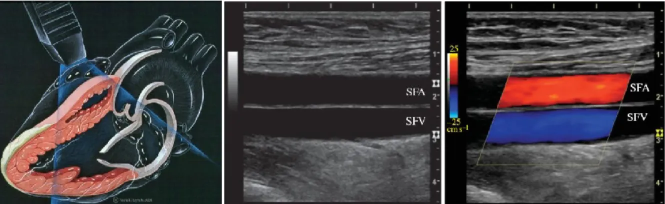 Fig. 3.1 – Left panel: Ultrasound echocardiography examination. Center Panel: B-mode image of the superficial femoral 