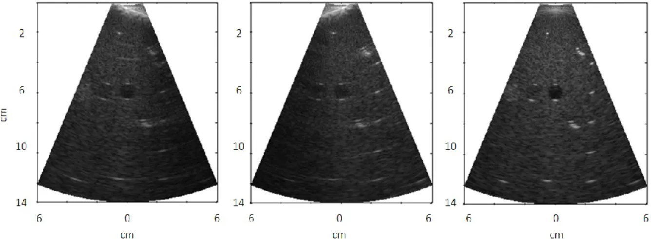 Fig. 3.14 – Diverging waves images and coherent compounding. Sectorial images obtained using single diverging 