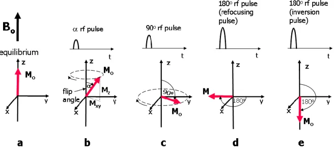 Figure 3: Illustration of differing states of magnetization: a) equilibrium state in which net magnetization (M0 ) is aligned  with the B 0  field along the z-axis; b) an rf pulse applied resulting in a flip angle α (less than 90°) causing net magnetization 