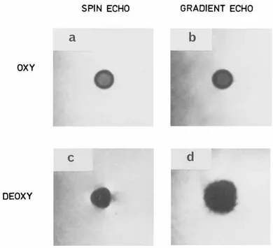 Figure 8: Oxygenated and deoxygenated blood compared using spin-echo and gradient-echo sequences 6 