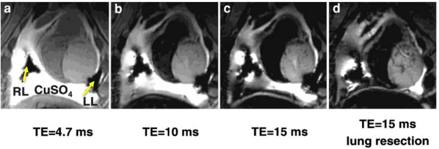 Figure 10: Post-euthanasia images with chest cavity filled with aqueous CuS04 . Images a-c show the effect of varying TE on  the image distortions, while d shows the effect of partially resecting the lungs on apical artifacts