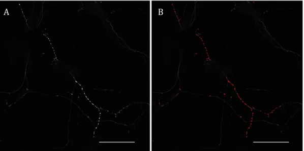 Figure	 6	 –	 Immunomarquage	 GFP	 correspondant	 à	 un	 segment	 de	 l’arborisation	 axonale	 d’un	neurone	dopaminergique	issu	de	la	SNc.	A	:	Signal	brut	après	l’acquisition	au	microscope	 confocal.	B	:	Sélection	du	signal	correspondant	aux	varicosités	après	avoir	défini	les	critères	 de	sélection	à	l’aide	du	logiciel	Image-J.	Echelle	=	100µm 	