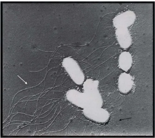 Figure 7 : Première observation directe de la présence de fimbriae chez E. coli 