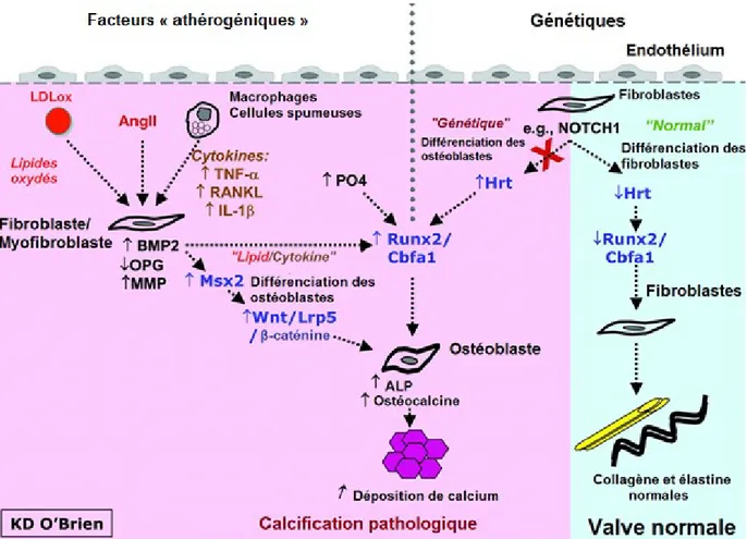 Figure 3. Représentation des interactions entre les lipides, l’inflammation et la génétique dans  la  pathogénèse  de  la  calcification  de  la  valve  aortique