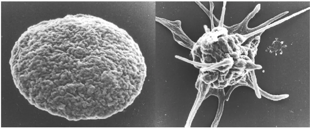 Figure 1.2 : Images prises par microscopie électronique à balayage. Gauche : plaquette au repos ;  Droite  :  plaquette  activée  (formation  des  filopodes)