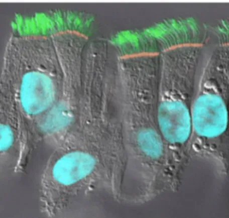 FIGURE  5.  Expression  du  CFTR  dans  les  cellules  épithéliales  humaines  bronchiques  différenciées