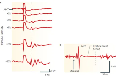 Figure  4 :  Réponse  à  une  impulsion  unique  de  stimulation magnétique transcrânienne 