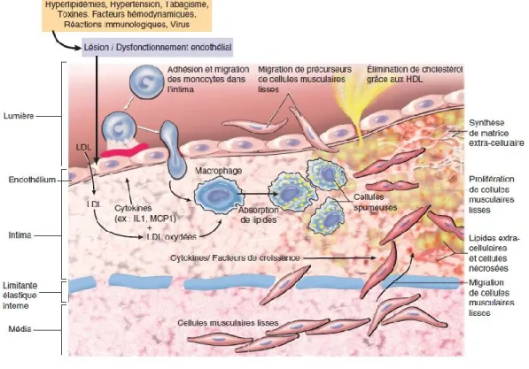 Figure  9.  Formation  et  développement  de  la  plaque  d’athérosclérose.  Les  facteurs  de  risque  des  maladies  cardiovasculaires  activent  l’endothélium