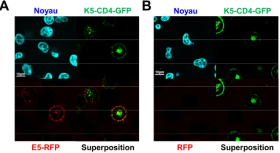 Figure V-6. Attachement et internalisation de la RFP avec/sans Ecoil sur les  cellules mixK5