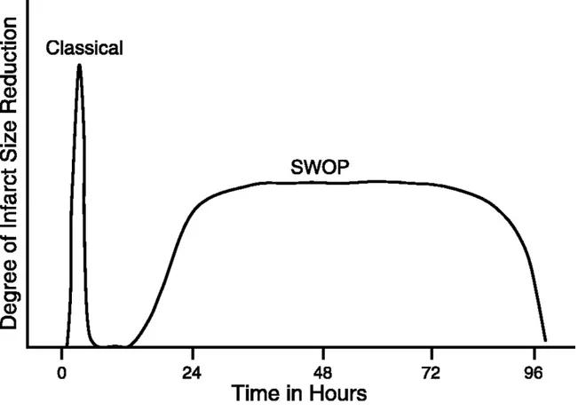 Figure  1.  Représentation  graphique  des  effets  des  deux  plages  du  préconditionnement 