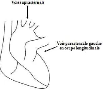 Figure 7 : Deux voies d’exploration du cœur utilisées pour l’étude des paramètres de  rigidité vasculaire en échographie bidimensionnelle 2D
