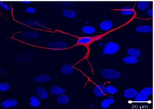 Figure 3. Nestin Expressing Cell    Nestin (red) expressing cell isolated from rat atria