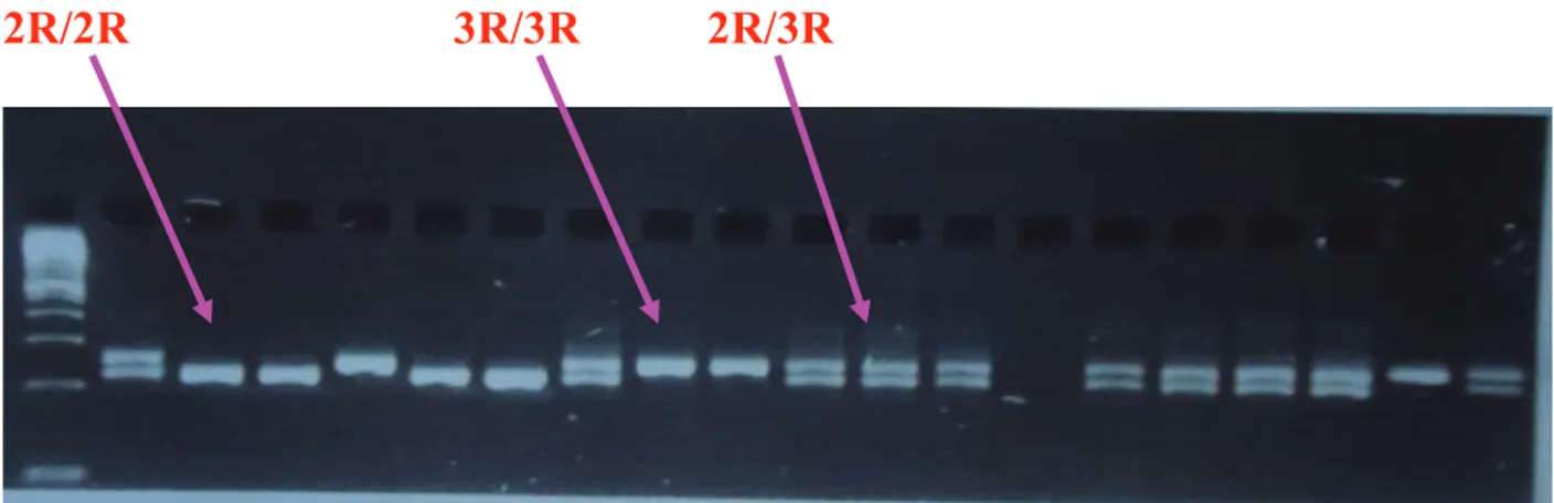 Figure 2: TS triple repeat (3R) 28 bp genotyping:  