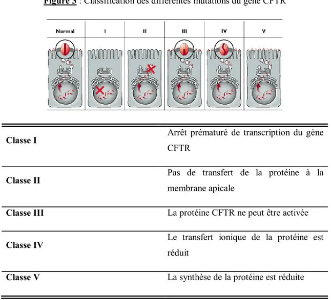 Figure 3 : Classification des différentes mutations du gène CFTR 