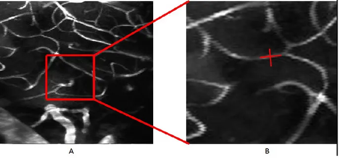 Figure 3.4. Angiogram  of vessels stained with  fluorescent  indicators. A. Region  of interest