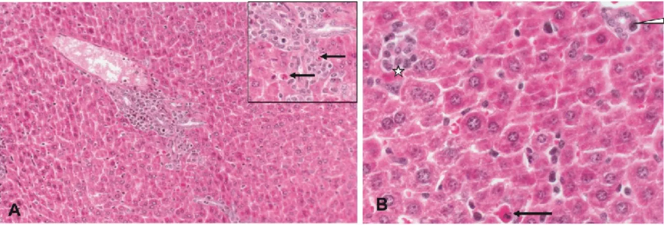 Figure 2.9.2 – Liver histopathology of a NSG mouse with xeno-GvHD. 