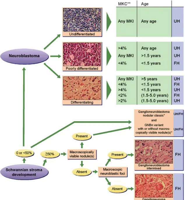 Figure  2  –  Système  de  classification :  International  Neuroblastoma  Pathology  Classification