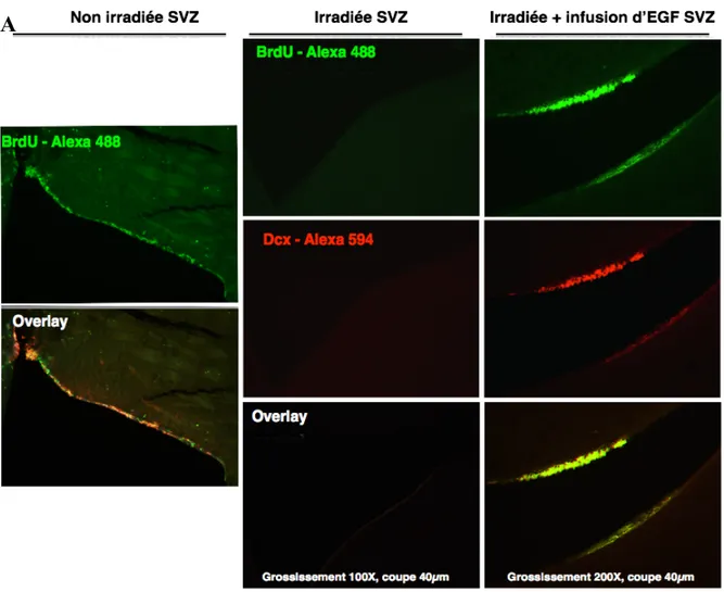 Figure 12. Effet de l’EGF sur la formation et la prolifération des jeunes neurones  Dcx(+)