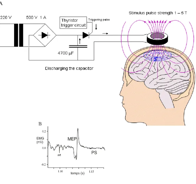 Fig. 10 : La stimulation magnétique transcrânienne évoque une réponse dans l’EMG.  