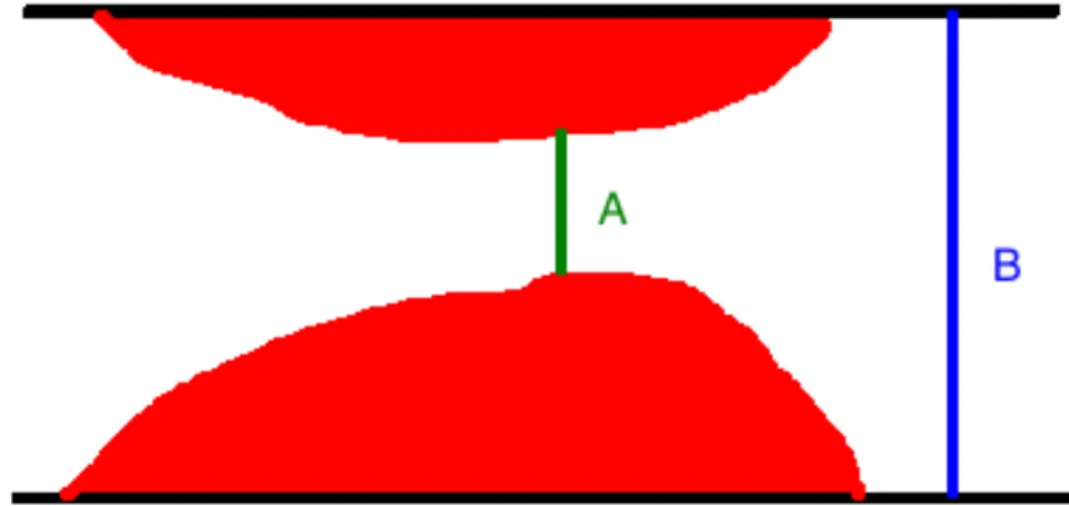 Figure	
   4	
  :	
   Représentation	
   schématisée	
   d’une	
   image	
   de	
   la	
   plaque	
   athérosclérotique	
   (en	
   rouge)	
   dans	
   un	
   vaisseau	
   (contours	
   du	
   vaisseau	
   en	
   noir).	
   	
   A	
   représente	
   le	
   diamètre	
   minimal	
  de	
  la	
  lumière	
  du	
  vaisseau.	
  	
  B	
  représente	
  le	
  diamètre	
  du	
  vaisseau	
  de	
  référence.	
  	
   Le	
  pourcentage	
  de	
  sténose	
  sera	
  ainsi	
  calculé	
  ici	
  comme	
  étant	
  (B-­‐A)/B	
  x	
  100.	
  