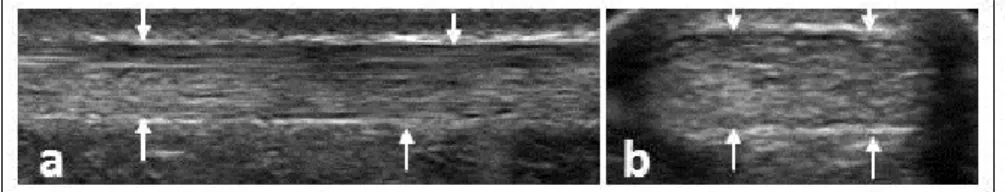 Figure 2.10  Images ultrasonographiques d’un TA sain : (a) image en vue longitudinale,  (b) image en vue transversale