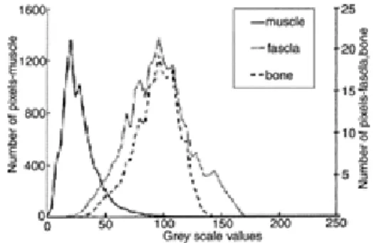Figure 2.24  Histogrammes des niveaux de gris du muscle sus-épineux, du fascia situé entre 