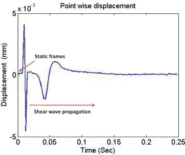 Figure 4.2 shows the point wise displacement of the central point in the ROI for phantom B