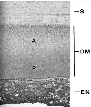 Figure 3: Transmission electron microscopy (TEM) of Descemet’s 