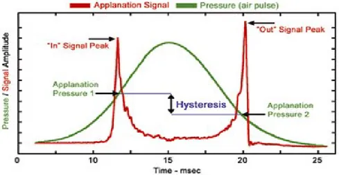 Figure 9. The ocular response analyzer measurement curve  (from:  www.reichert.com ) 