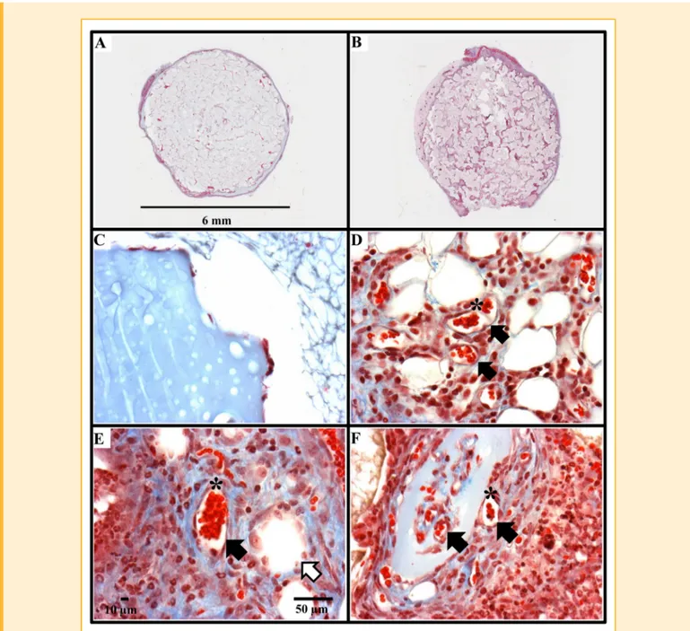 Fig. 1. Pro-angiogenic and in ﬂammatory activities of VEGF and angiopoietins in mice. The images illustrate representative scans (A and B) and representative histological sections (Masson ’s trichrome staining, 400 magniﬁcation) of PVA sponges soaked in g