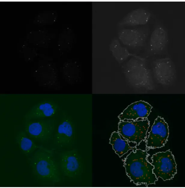 Figure 2.9: Real-world segmentation example. Top panels: GFP signal with normal and gamma corrected scaling to emphasize low intensities, respectively