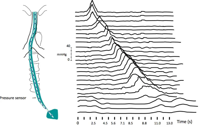 Figure 4.    Manometric study with a HRM catheter without EPT. 